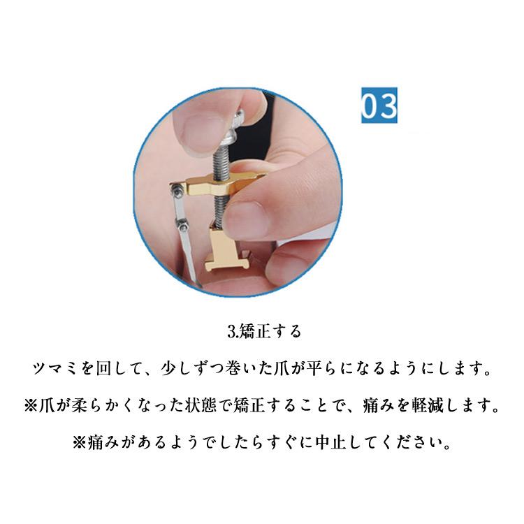 ネイルケア 2個入り 収納ボックス付き 矯正ツール 巻き爪 陥入爪 矯正