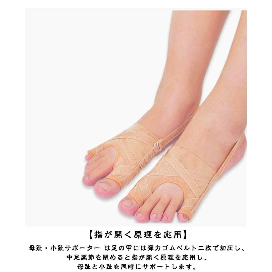外反母趾サポーター 足指セパレーター 小指 足指サポーター 寝指 親指