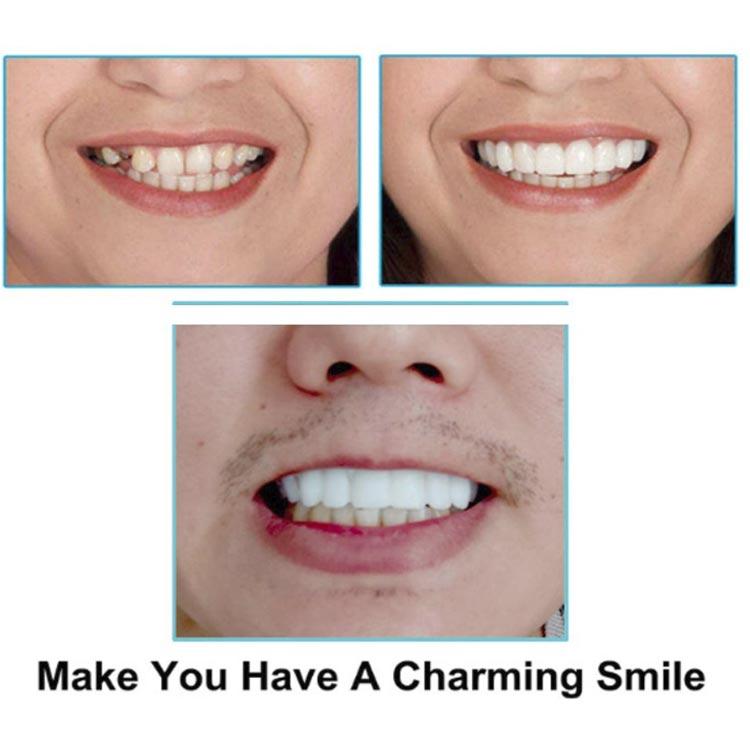 簡易つけば歯 仮歯 歯にかぶせる 義歯 自分で作る 上下セット カバー