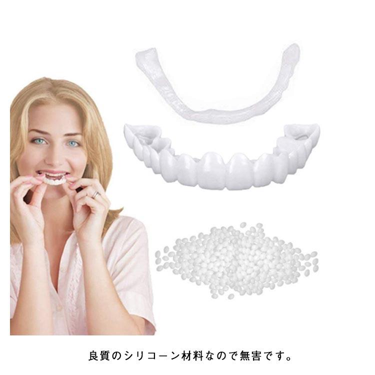 簡易つけば歯 仮歯 歯にかぶせる 義歯 自分で作る 上下セット カバー