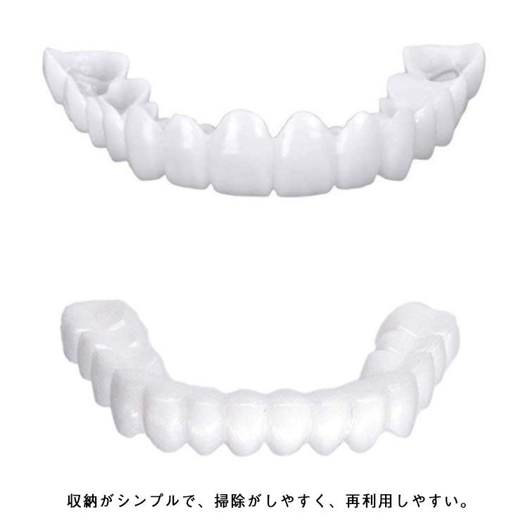 簡易つけば歯 仮歯 歯にかぶせる 義歯 自分で作る 上下セット カバー