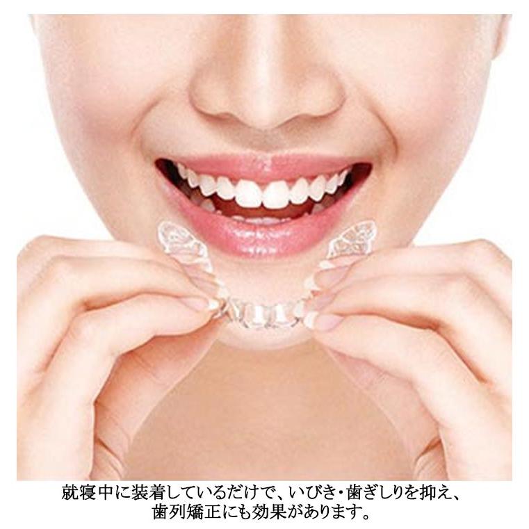 歯ぎしり デンタルマウスピース 食いしばり 防止 マウスピース 