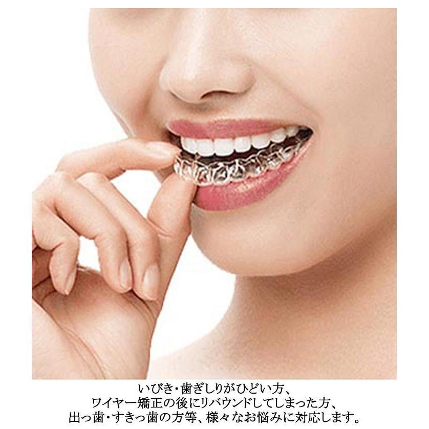 歯ぎしり デンタルマウスピース 食いしばり 防止 マウスピース