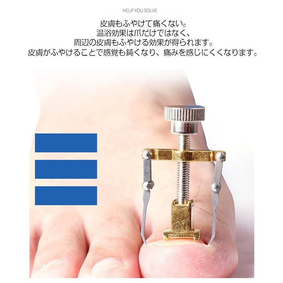 セット ネイル セルフケア 巻爪ケア 巻爪 防止 対策 まき爪 巻き爪