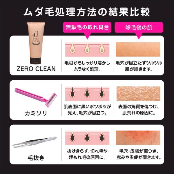 除毛 クリーム ゼロクリーン 薬用 簡単 自宅 除毛剤 除毛液 IPL光脱毛