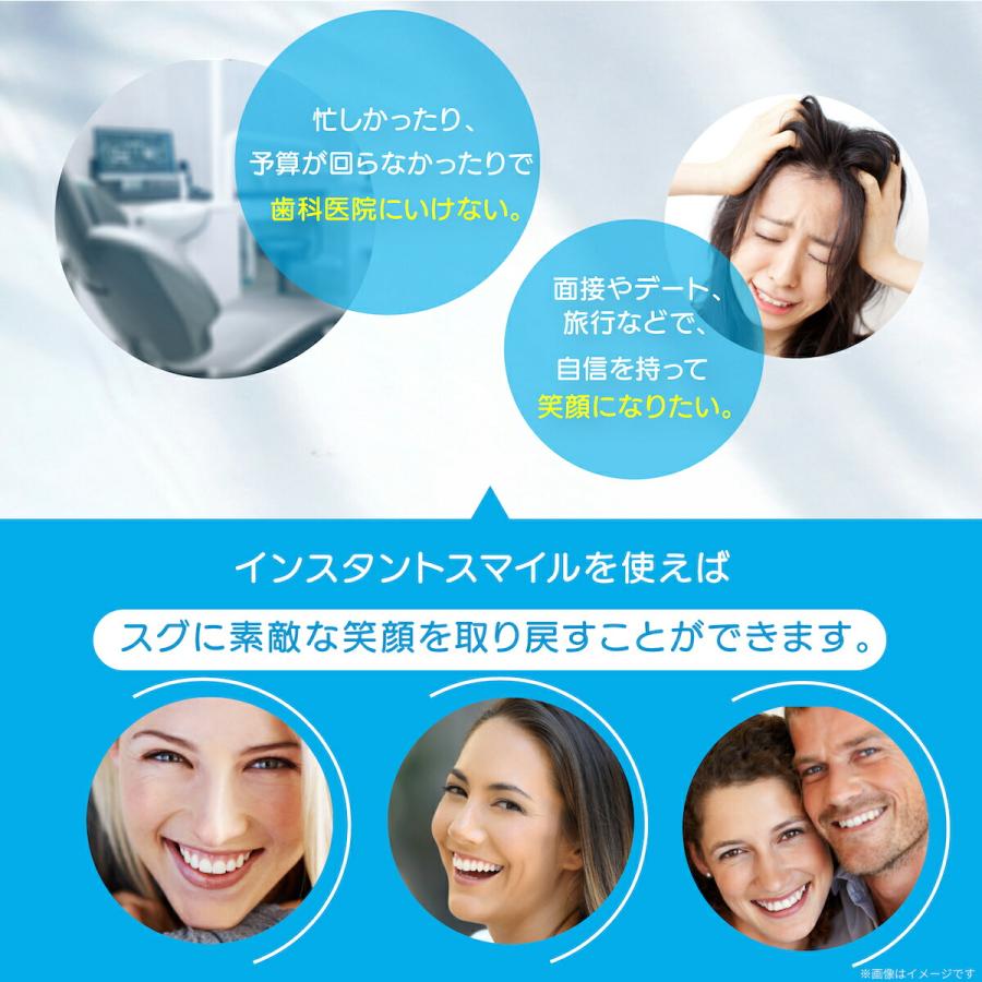 インスタントスマイル　上歯　スモール S インスタントスマイルDX スモール ティース 上歯用付け歯 女性向け