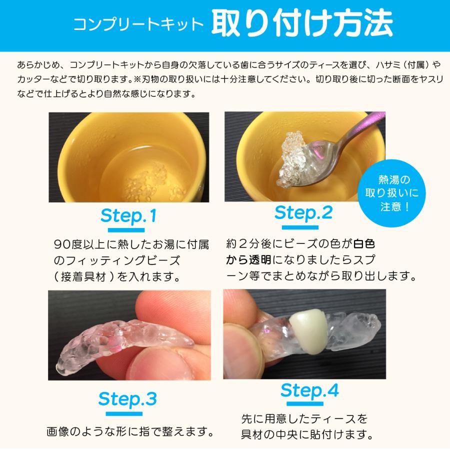 インスタントスマイル コンプリートキット 接着剤付 4色入 義歯 上歯