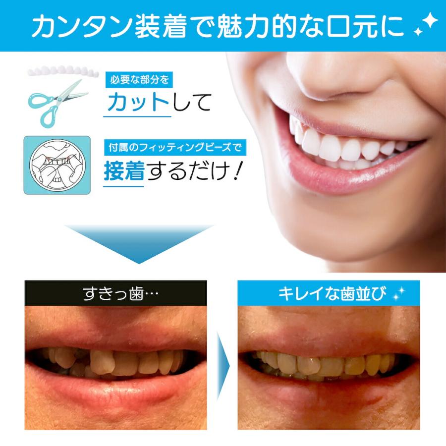 インスタントスマイル コンプリートキット 入れ歯 義歯 入歯 義歯仮歯