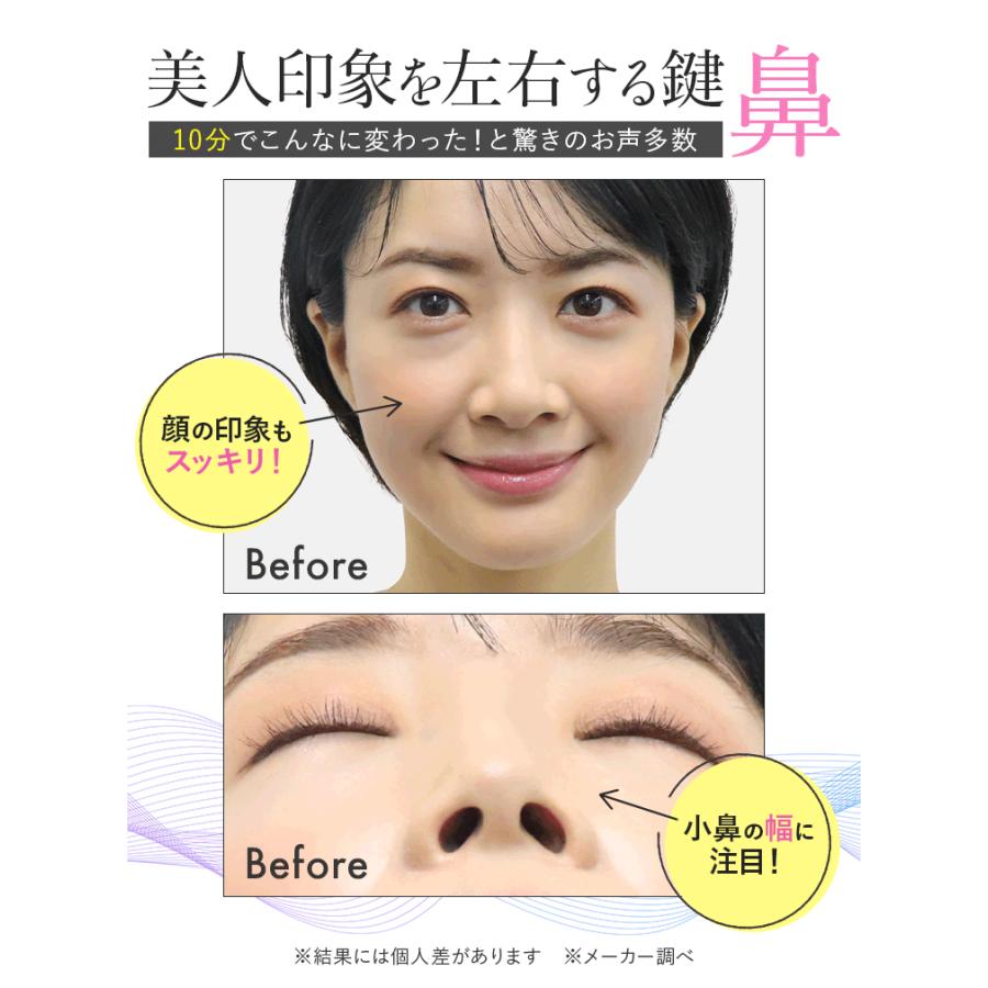 LUXCEAR（ルクセア） 鼻専用 EMS 美顔器 LUXCEAR Fornez フォーネス