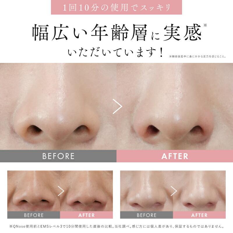 鼻美顔器 QNose+EMS EYE LIFTセット NIPLUX 鼻専用美顔器 キュノーズ