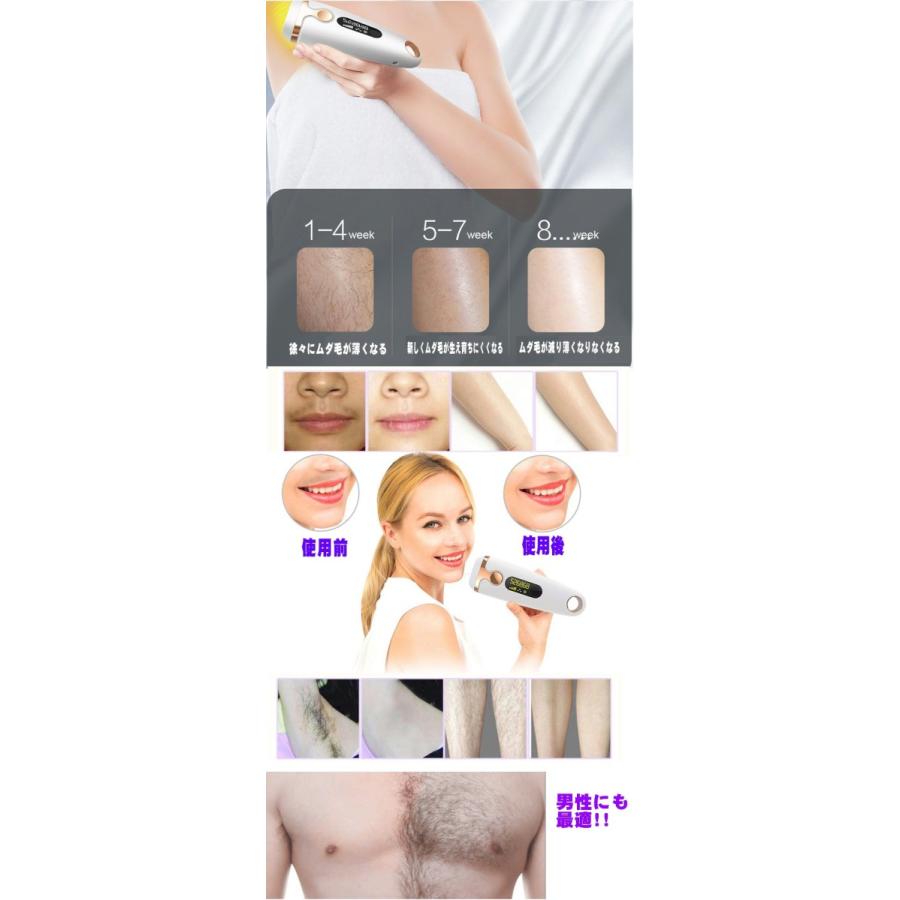 光脱毛器 最新型 女性 メンズ 軽量 人気 光IPL脱毛器 VIO エステ