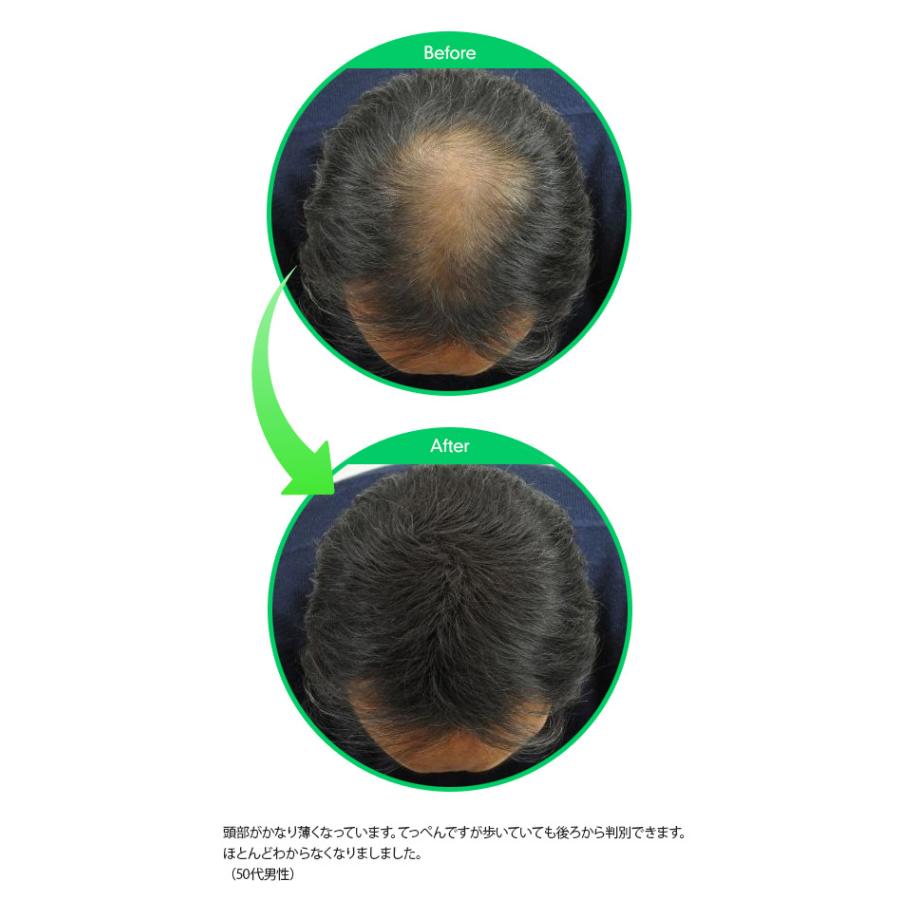 マジックパウダー 50g ダークブラウン【薄毛隠し 薄毛カバー 薄毛対策 白髪隠し 白髪カバー 瞬間増毛 増毛 男女兼用 円形脱毛 クラウン MAGIC POWDER】 |  | 02