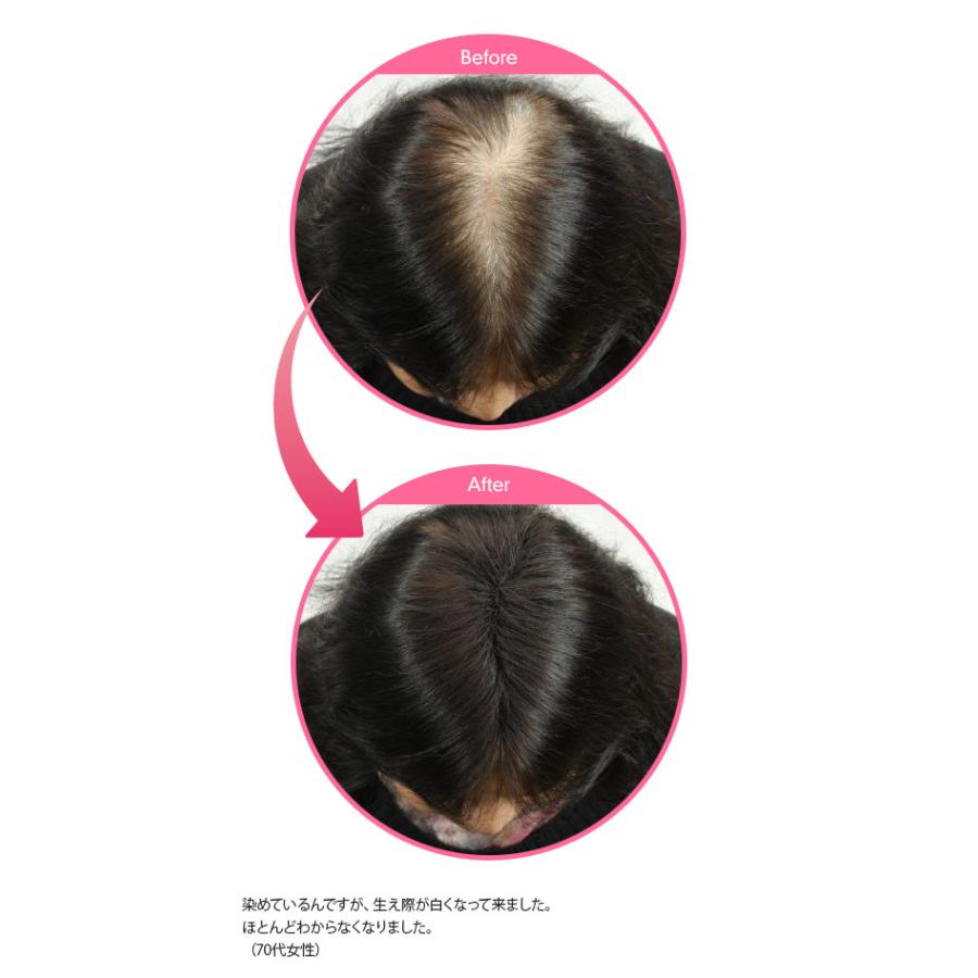 マジックパウダー 50g ダークブラウン【薄毛隠し 薄毛カバー 薄毛対策 白髪隠し 白髪カバー 瞬間増毛 増毛 男女兼用 円形脱毛 クラウン MAGIC POWDER】 |  | 03