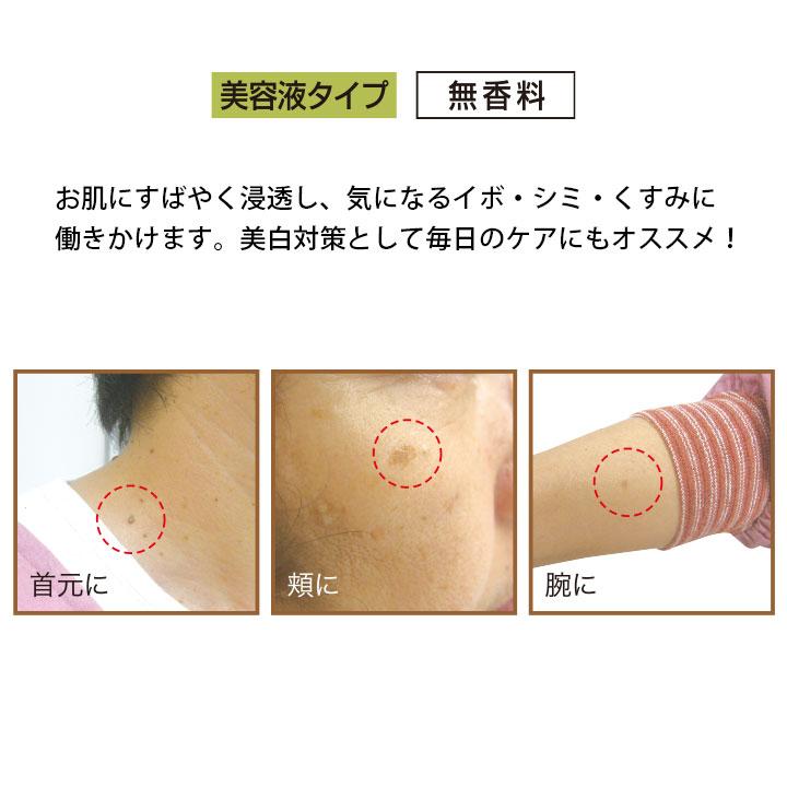 イボ しみ くすみ対策 フェイス スキン ケア 老人性ゆうぜい専用美容液