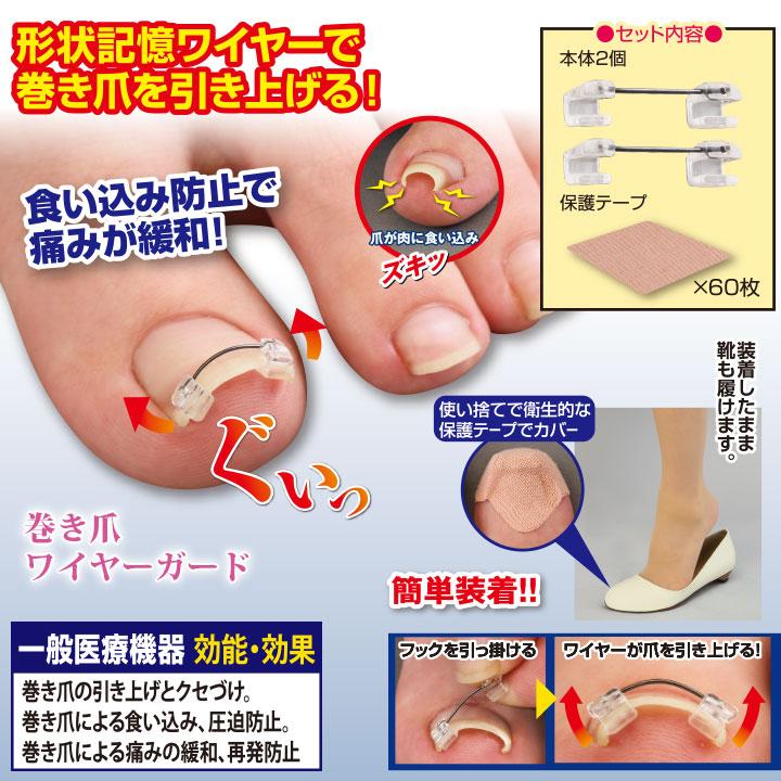 健康グッズ 巻き爪矯正 サポーター 痛み 緩和 巻き爪ワイヤーガード Z0517 巻きづめ 食い込み防止 一般医療機器 アビバーレ｜avivare｜03