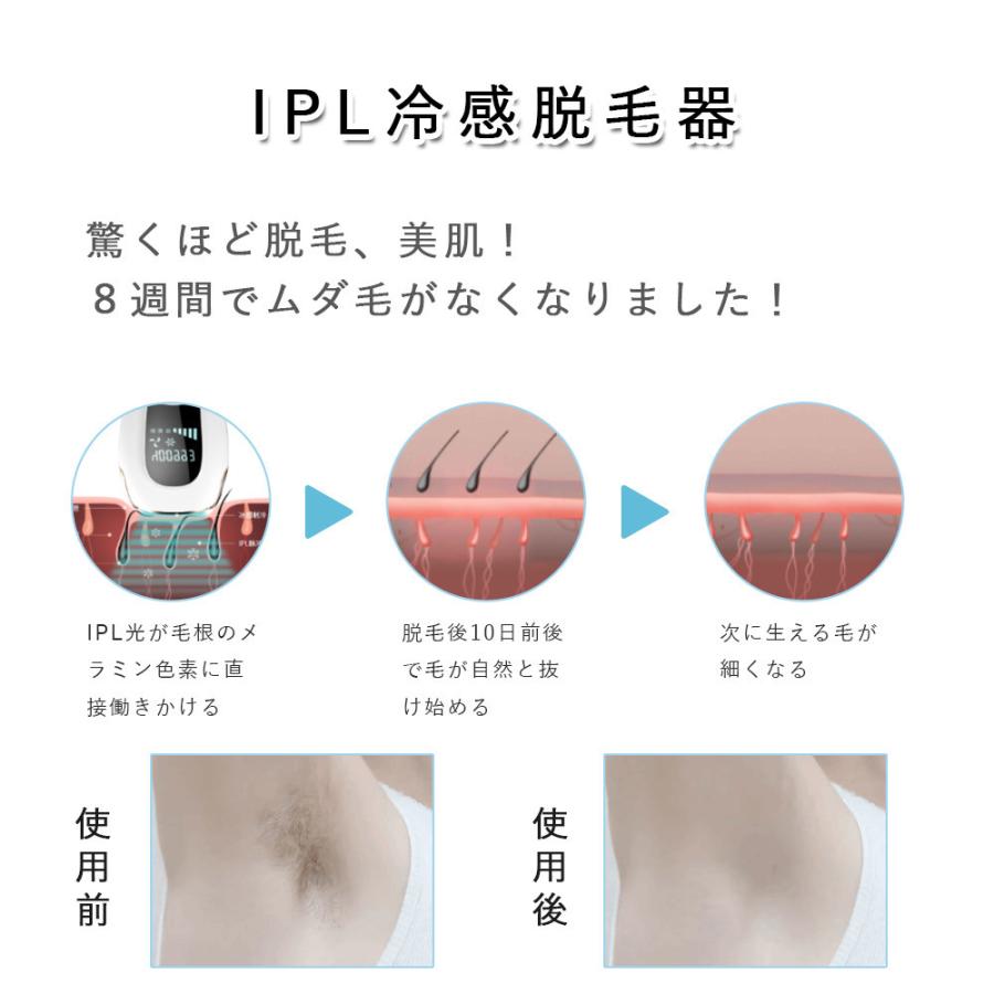 光美容器 脱毛 除毛器 フラッシュ 脱毛器 メンズ vio vio対応 光美容器 脱毛 除毛器 フラッシュ 脱毛器 メンズ vio vio対応