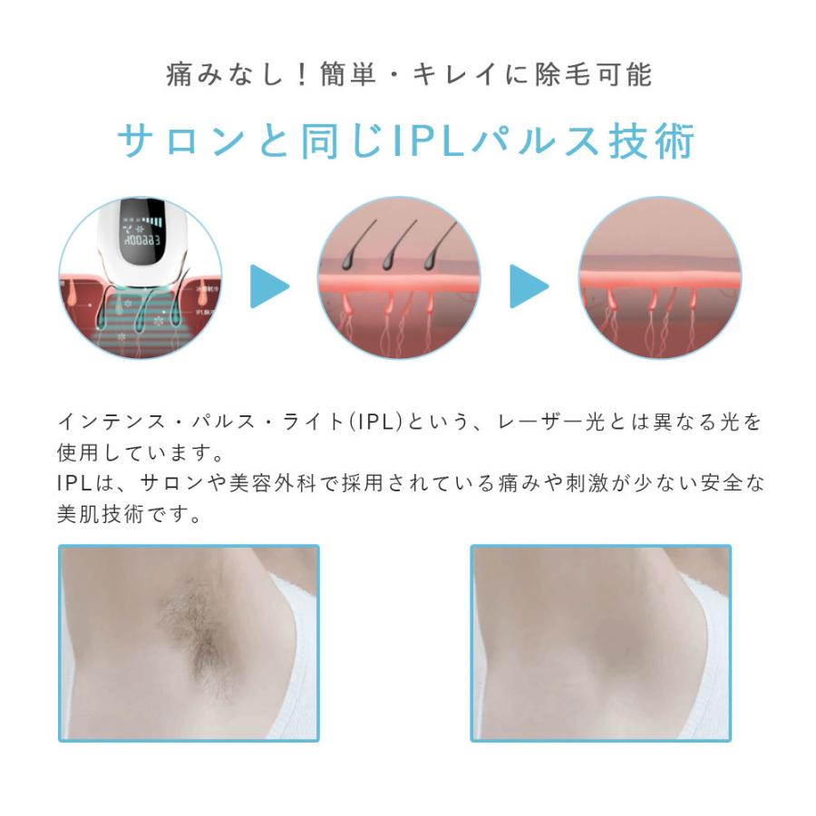在庫1点❣️ 脱毛器 VIO対応 レディース メンズ 家庭用脱毛器 全身脱毛 脱毛器 vio対応 全身脱毛 男女兼用 家庭用 冷感脱毛 光美容器 メンズ