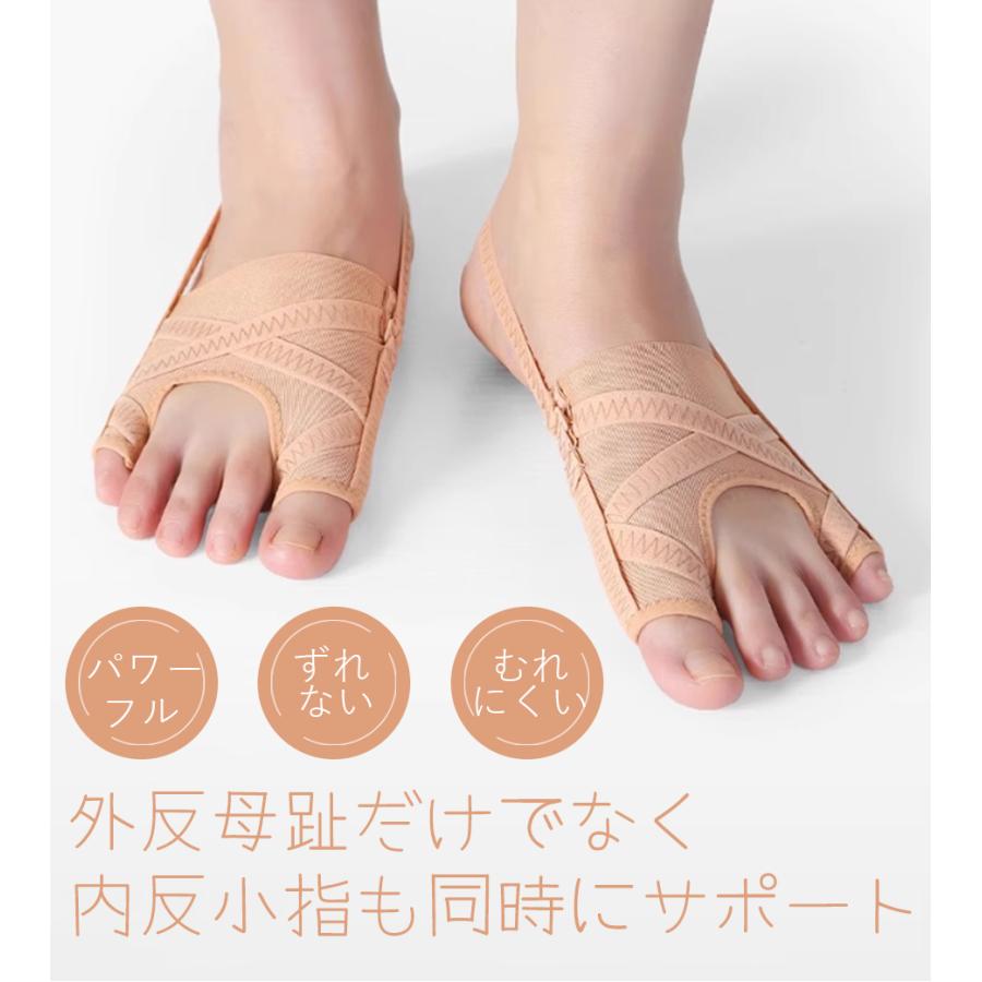 即納 外反母趾 外反母趾サポーター 内反小趾 足指サポーター 足指セパレーター 親指 小指 矯正 足裏 アーチ 寝指 浮き指 左足 右足 左右セット むくみ |  | 01