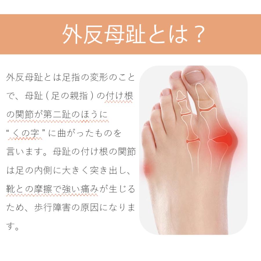即納 外反母趾 外反母趾サポーター 内反小趾 足指サポーター 足指セパレーター 親指 小指 矯正 足裏 アーチ 寝指 浮き指 左足 右足 左右セット むくみ |  | 03