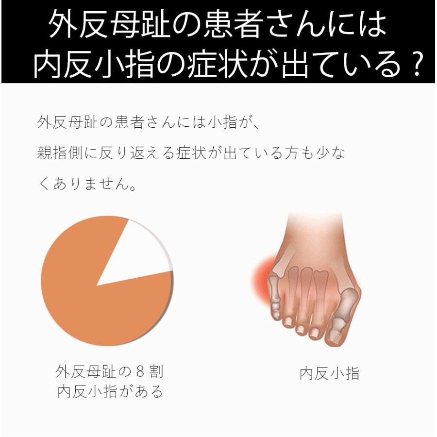 即納 外反母趾 外反母趾サポーター 内反小趾 足指サポーター 足指セパレーター 親指 小指 矯正 足裏 アーチ 寝指 浮き指 左足 右足 左右セット むくみ |  | 04