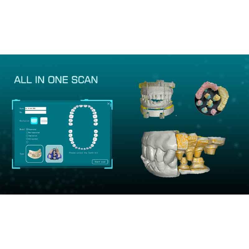 Thunk3Dディスクトップ歯科用スキャナーセット（DT300） : AYARDYahoo