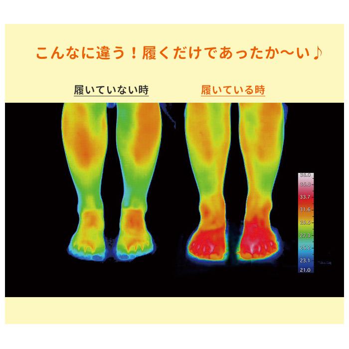 ルームソックス 通販ルームソックス レディース 暖かい 靴下 おしゃれ くつ下 あったか 厚手 ソックス 秋冬 かわいい 短い ショート丈 ショート  ルームソックス |  | 19