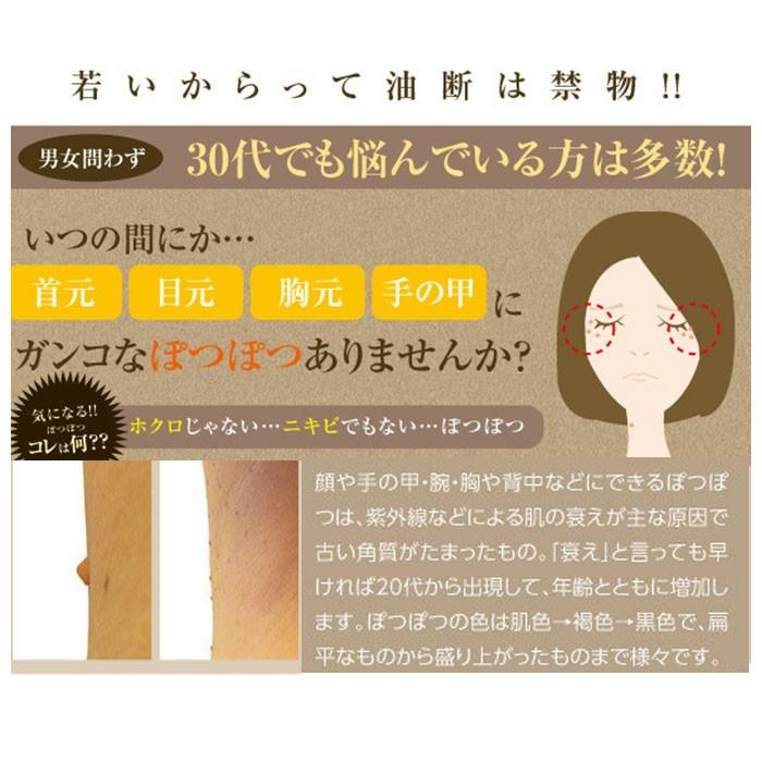 角質粒 通販角質粒 除去 ぽっつるん イボ いぼ クリーム 対策 ハトムギ イボ取り 首 胸元 胸もと デコルテ 顔 背中 ぶつぶつ ぽつぽつ スキンケア コスメ 角質粒 |  | 06