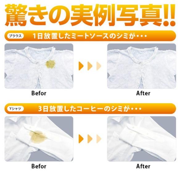 スポッとる 染み抜き剤 ビックサイズ 150ml スポットル 染み抜き