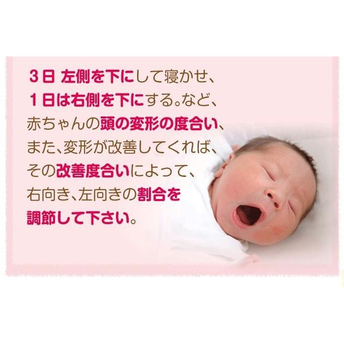 絶壁 枕 向き癖 赤ちゃん 絶壁防止 ドーナツ枕 向き癖防止枕 横向き 矯正 ベビー 新生児 天使のねむり カバー1枚 ヘルメット治療 向き癖防止 頭の形 まくら A0002 バランスボディ研究所 通販 Yahoo ショッピング