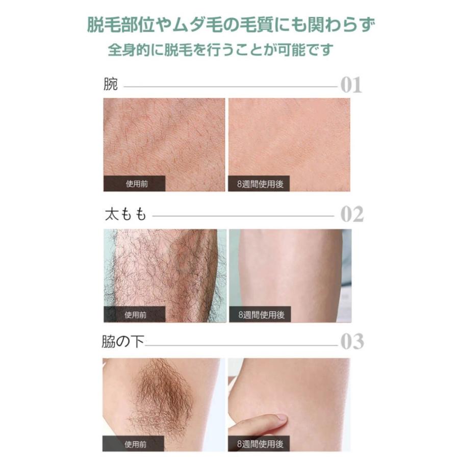 数量限定 Anlan 脱毛器 冷感脱毛器 Ipl脱毛器 フラッシュ式脱毛器 冷感ipl 光美顔器 無痛脱毛 家庭用脱毛器 光 背中 家庭用 痛くない脱毛 メンズ 髭 美顔器 一年間保証 日本最大級 Iniciatupyme Cl