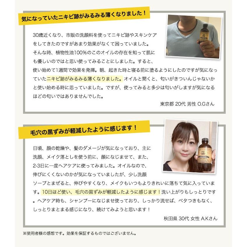 ひまし油 即日出荷 オーガニック ジャマイカン ブラックキャスターオイル 118ml 無添加 有機 サニーアイル 髪 黒ひまし油 未精製 エドガーケイシー カソーダ ヒマシ油