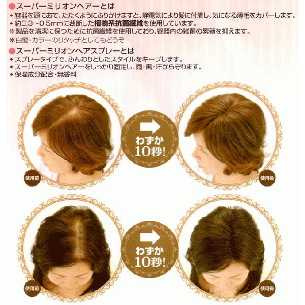 スーパーミリオンヘアー レディースセット No.3 ライトブラウン スーパーミリオンヘアー レディースセット No.3 ライトブラウン