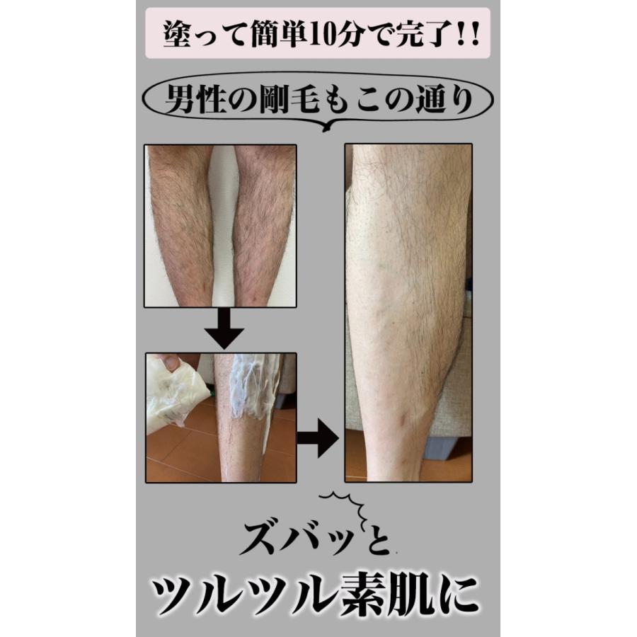 超得3個セット→1本あたり1,500円】徹底除毛なのに肌を守る！低刺激