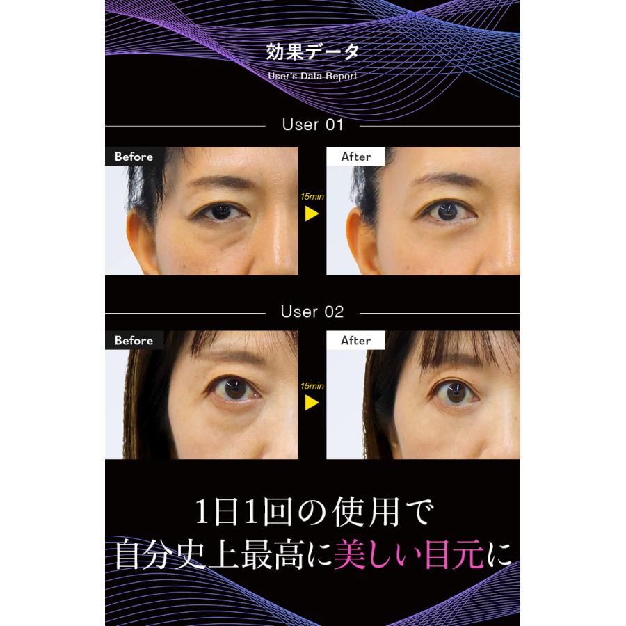 LUXCEAR 【公式】目元専用美顔器 ミューサー 目元専用美顔器 LUXCEAR 【公式】目元専用美顔器 ミューサー 目元専用美顔器