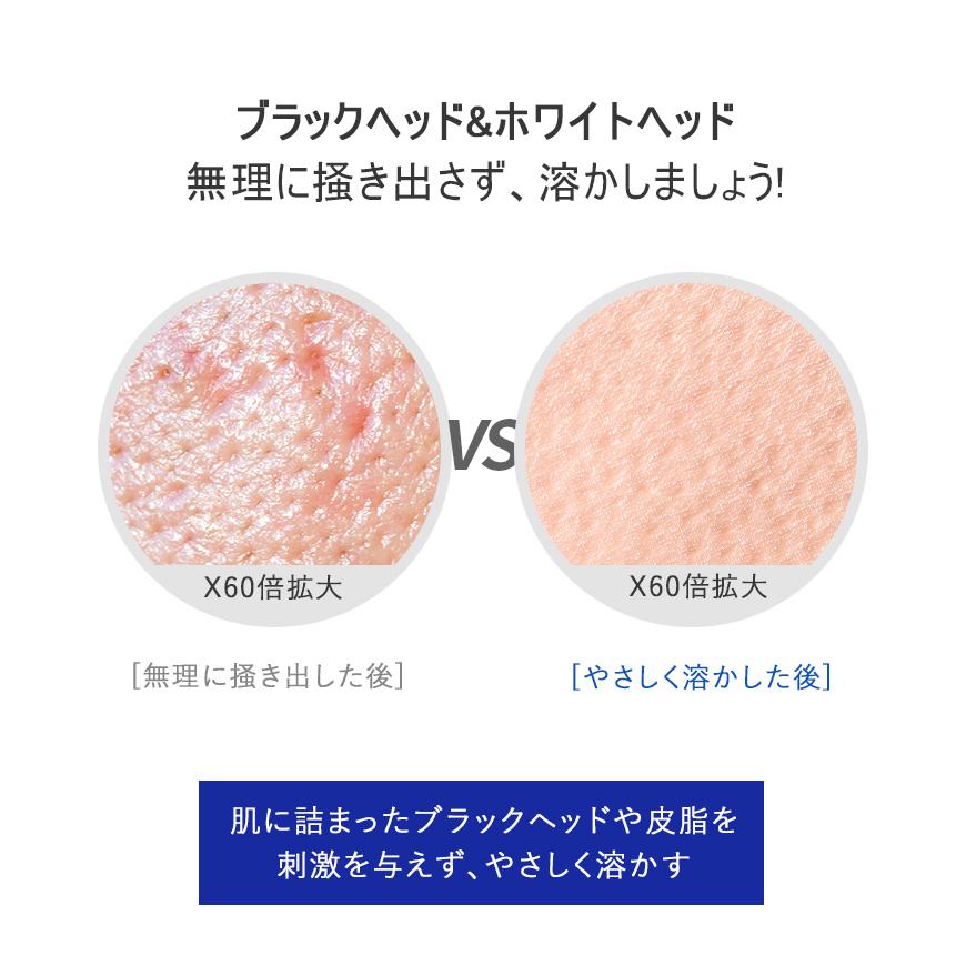 ワンデイズユー ノーモアブラックヘッド 100ml one day syou ブラックヘッド 皮脂 角質 いちご鼻 毛穴 鼻パック 鼻 低刺激 植物エキス lattencos :one001:beauty studio - 通販 - Yahoo!ショッピング ワンデイズユー ノーモアブラックヘッド 100ml one day syou ブラックヘッド 皮脂 角質 いちご鼻 毛穴 鼻パック 鼻 低刺激 植物エキス lattencos :one001:beauty studio - 通販 - Yahoo!ショッピング
