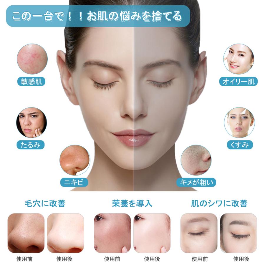 在庫処分セール 美顔器 Ems 多機能 イオン導入器 Rfラジオ波 Led光エステ 引き締め 美肌 小顔 美容器 抗老化しわ除去 保湿 毛穴 黒ずみ 汚れ除去 たるみ Hu Sk007 Gerberamint 通販 Yahoo ショッピング