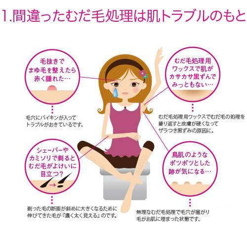 BRAUN 脱毛器 光 家庭用脱毛器 光脱毛器 ムダ毛処理 女性 脱毛 BRAUN 脱毛器 光 家庭用脱毛器 光脱毛器 ムダ毛処理 女性 脱毛