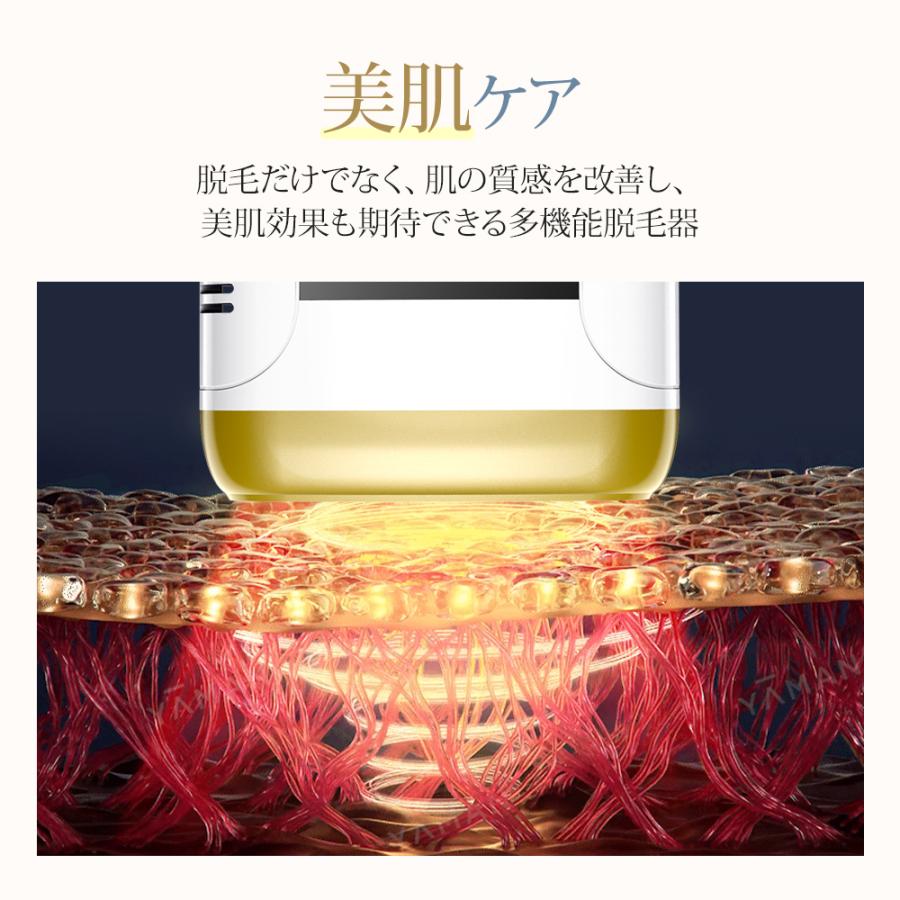 脱毛器 hipl光脱器 vio対応 9段階調節 脇 腕 足 背中 家庭用 ボディ