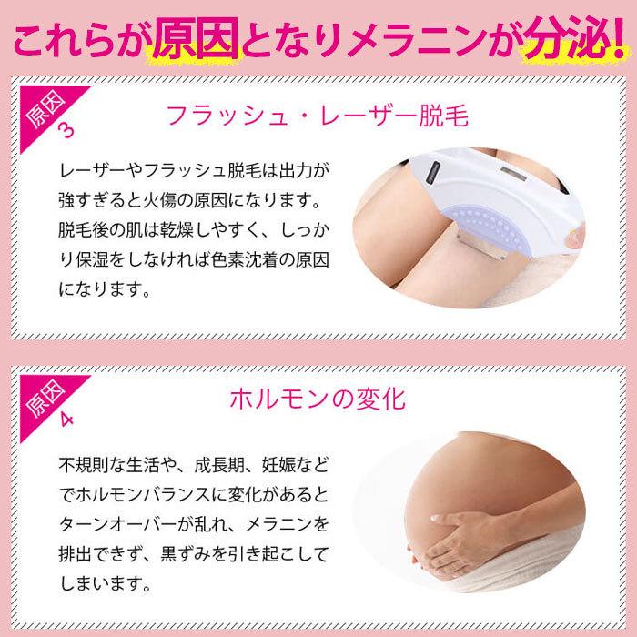 デリケートゾーン 黒ずみ Vio 脇の下 美白 クリーム ドゥーピンク 全身の黒ずみケア バストトップケア ボディクリーム スキンケア Do Pink 送料無料 Dopink1 Bellseek 通販 Yahoo ショッピング