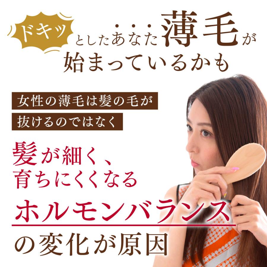 育毛剤 女性用 女性 育毛 ランキング 薄毛 スカルプ 抜け毛 予防 ベルタ育毛剤 2本 Belta Hairlotion 2 ベルタ公式ショップ 通販 Yahoo ショッピング