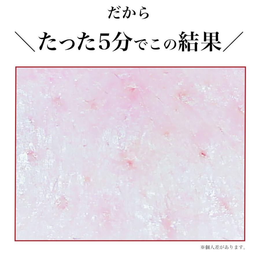 roserine Dr.’s esthetics アクアリフトピーリング ホワ… benext_rrn-awst01