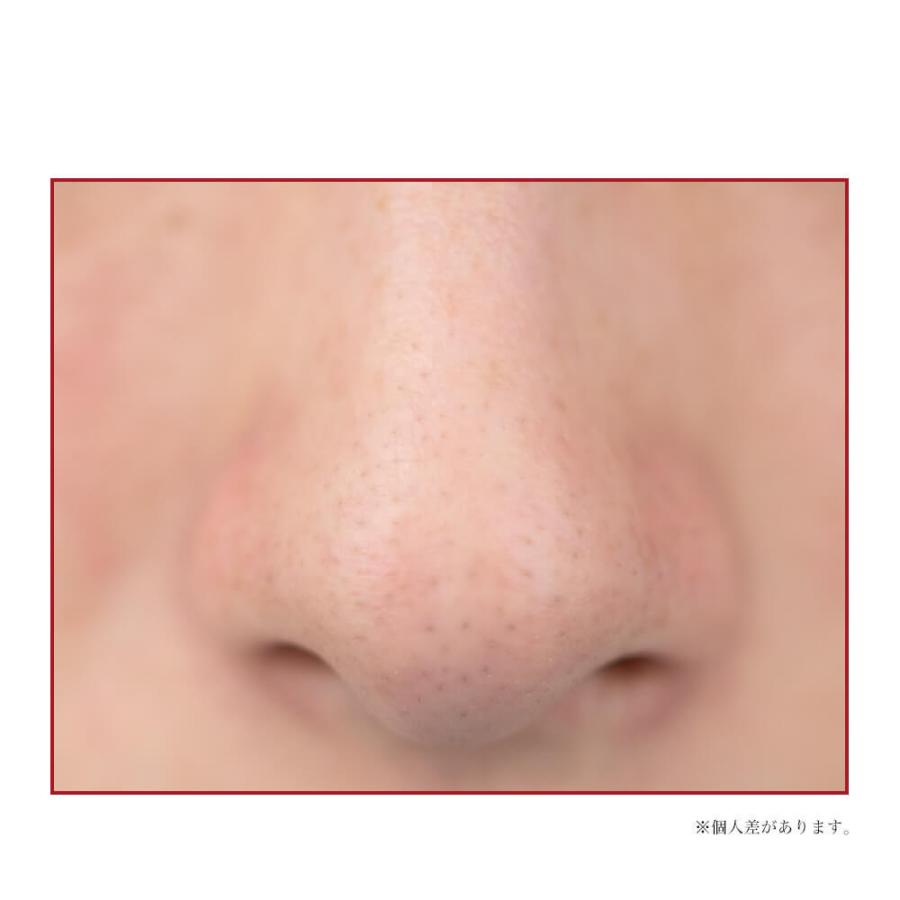 公式】roserine Dr.'s esthetics アクアリフトピーリング ウォーターピーリング 毛穴ケア 美顔器 防水 送料無料 正規品 ロゼリーヌ 毛穴 黒ずみ :RRN-AWST01:Anynext Yahoo!店 - 通販 - Yahoo!ショッピング 公式】roserine Dr.'s esthetics アクアリフトピーリング ウォーターピーリング 毛穴ケア 美顔器 防水 送料無料 正規品 ロゼリーヌ 毛穴 黒ずみ :RRN-AWST01:Anynext Yahoo!店 - 通販 - Yahoo!ショッピング