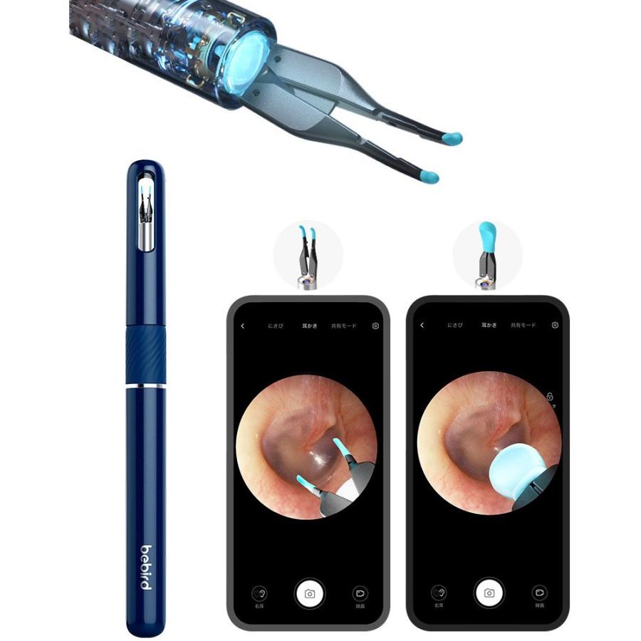 Bebird note5 スマート耳かき 推奨品】bebird スマート耳かき Note5 ネイビー : ベスト電器