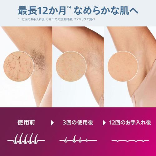Lumea 光美容器8000 BRI946 (箱なし) PHILIPS BRI946／70 ルメア 光美容 脱毛器 8000 シルバー : ベスト電器
