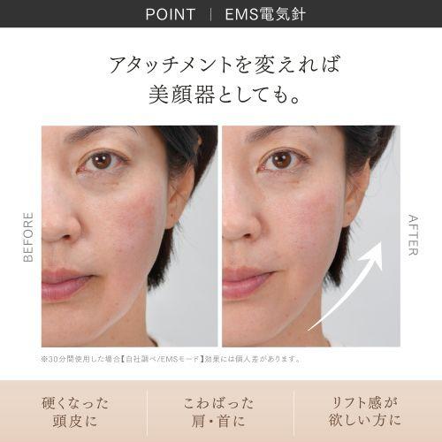 MYTREX MT-HSDX-24-B-B HEAD SPA DEEP X イオン電気針ヘッドスパ