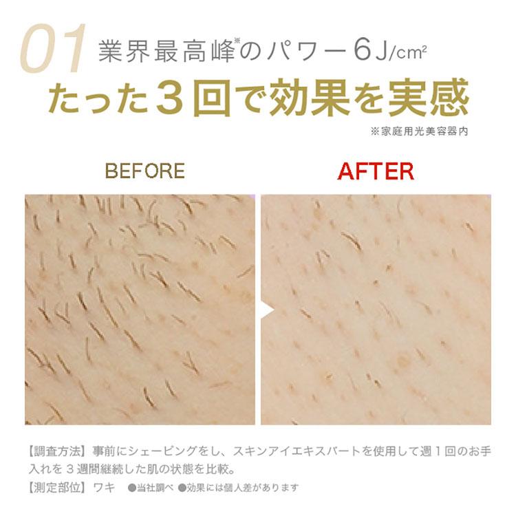 【未使用】ブラウン脱毛器BRAUN PL-5137 GOLD オーラルB ブラウン 脱毛器 光脱毛 BRAUN 光美容器 シルク