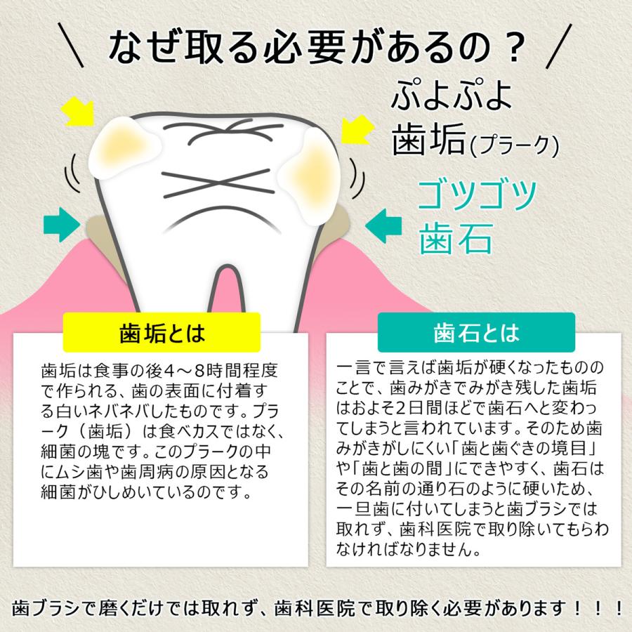 クーポンで引き！ 歯石取り スケーラー ケース付き 一般医療機器 初心者向け 器具 デンタルケア 犬 歯科 歯垢 ペット オーラルケア 送料無料 | ブランド登録なし | 05