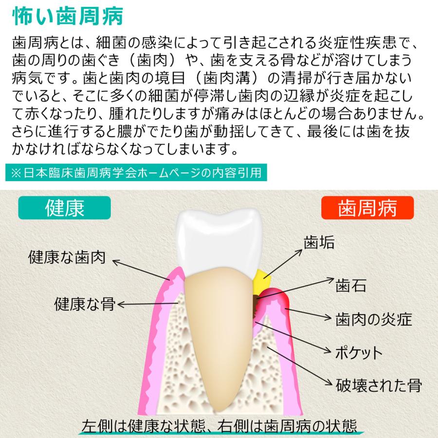 クーポンで引き！ 歯石取り スケーラー ケース付き 一般医療機器 初心者向け 器具 デンタルケア 犬 歯科 歯垢 ペット オーラルケア 送料無料 | ブランド登録なし | 06