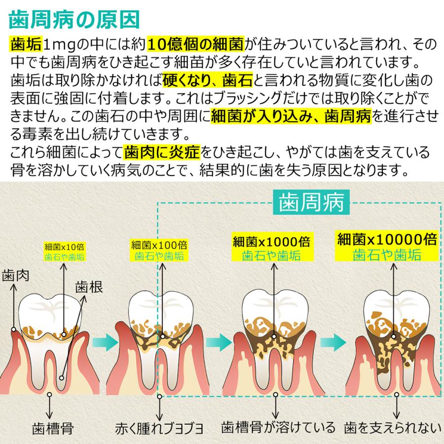 クーポンで引き！ 歯石取り スケーラー ケース付き 一般医療機器 初心者向け 器具 デンタルケア 犬 歯科 歯垢 ペット オーラルケア 送料無料 | ブランド登録なし | 07