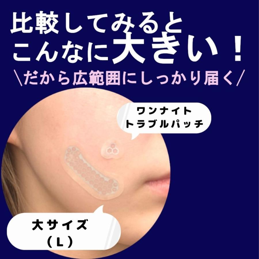 ワンナイトトラブルパッチ大きいサイズ誕生 マグネシウムマイクロ